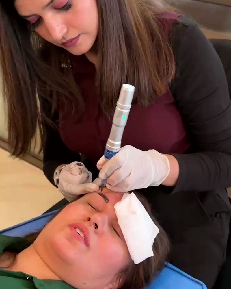 A derma pen treatment on a model with protective gauze over the eyes